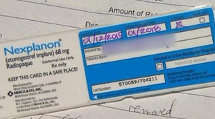 Woman gets pregnant again despite birth control implant CBS News