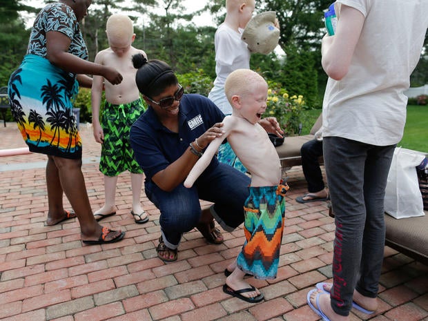 albino Baraka Lusambo