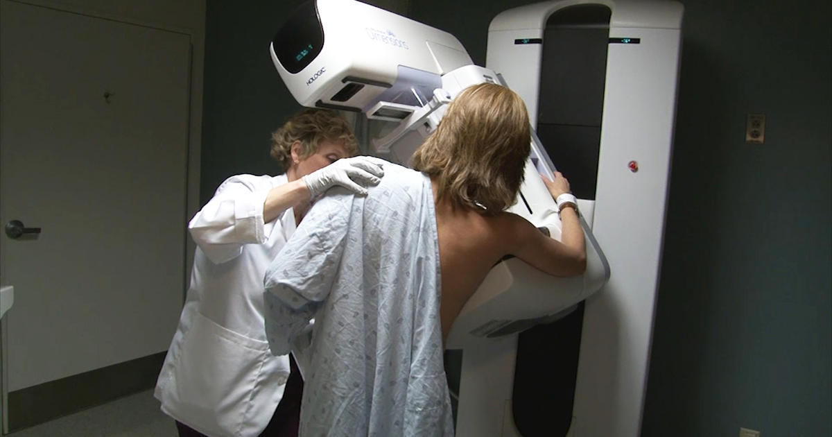 Fda Proposes New Mammogram Guidelines For Dense Breasts Cbs News