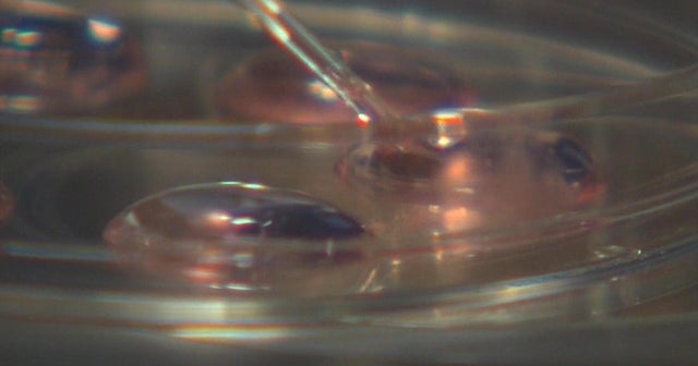 Judge orders frozen embryos be destroyed after divorce CBS News