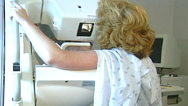 mammogram1.jpg 