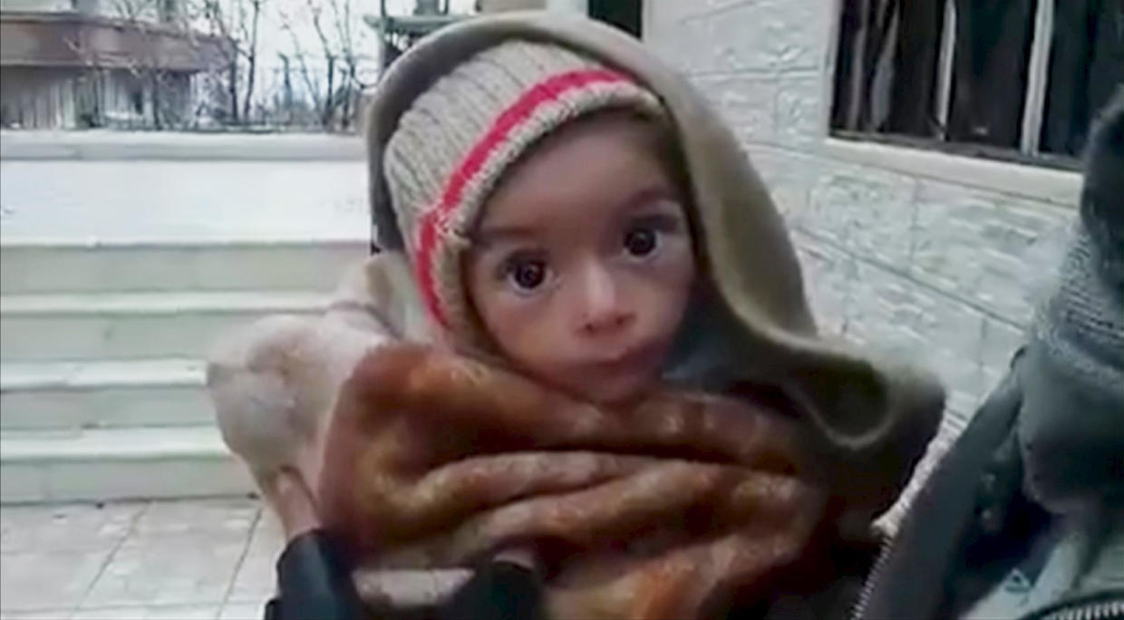Starvation In Syria Starvation As A Weapon Of War In Syria Pictures Cbs News