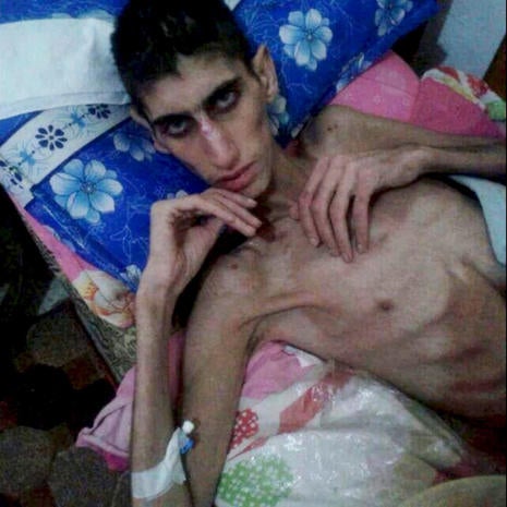 "Starvation as a weapon of war" in Syria 