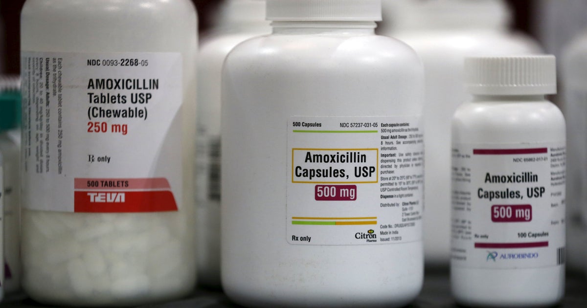A Digital Solution To Overprescription >> U S Doctors Still Overprescribing Drugs Like Antibiotics Cbs News A Digital Solution To Overprescription >> U S Doctors Still Overprescribing Drugs Like Antibiotics Cbs News