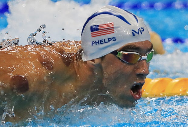 Why is "cupping" attracting Olympic athletes like Michael Phelps? - CBS