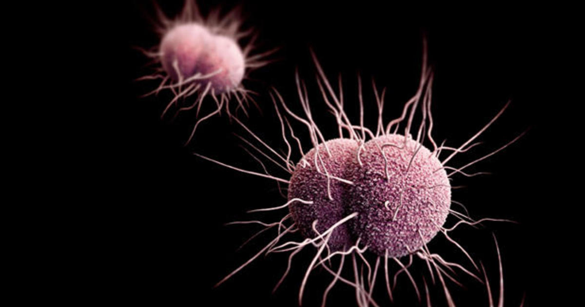Drug Resistant Gonorrhea A Growing Threat In The U S Cbs News
