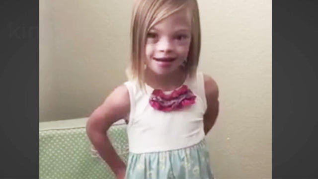 7 Year Old Girl Explains In Viral Video Why Down Syndrome Is Not Scary Cbs News