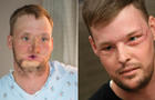 face-transplant-split.jpg 