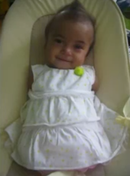 Mom S Inspiring Adoption Story Of 3 Year Old Girl Born Without Arms Or Legs Cbs News