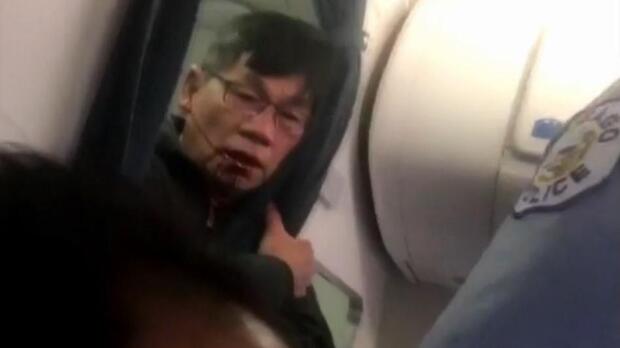 170411-facebook-united-passenger-bloody-face.jpg