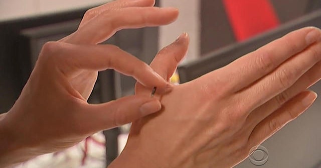 Wisconsin company offers to implant microchips in employees CBS News