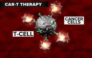 FDA approves breakthrough CAR-T therapy for leukemia