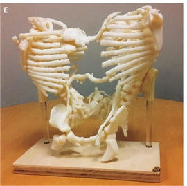 goldstein-nejm-cpc-10-17-2e.jpg