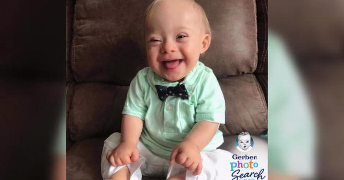 New Gerber baby is first ever with Down syndrome CBS News