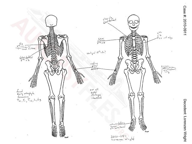 Lorenzen Wright Death Ex Wife Sherra Wright S Guilty Plea Latest Twist In Nba Star S Murder 48 Hours Cbs News
