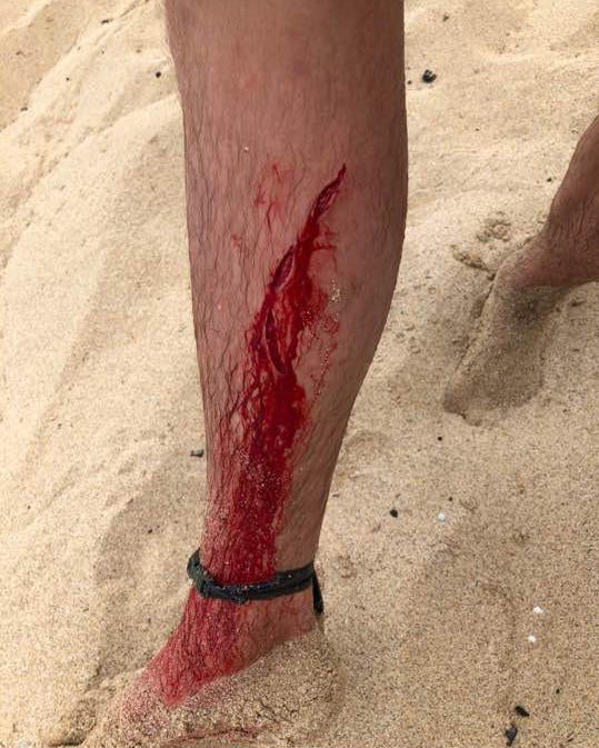 Shark Attacks Warning Graphic Images Cbs News
