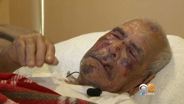 California woman arrested in beating of 92-year-old man California woman arrested in beating of 92-year-old man