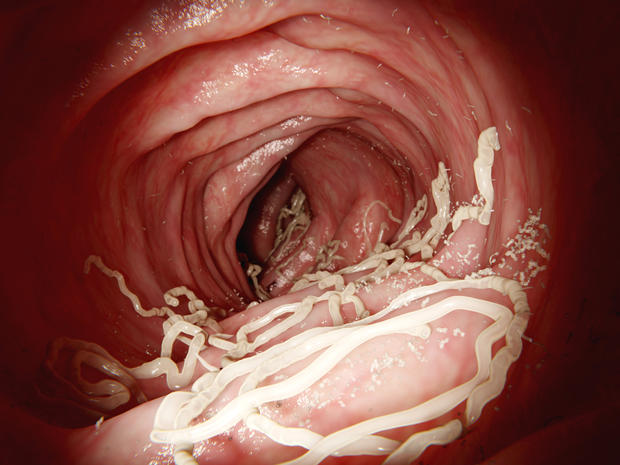 roundworm-2.jpg 