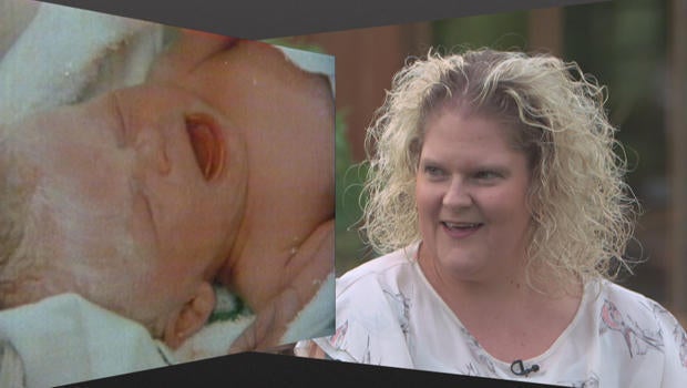 louise-brown-the-first-test-tube-baby-born-40-years-ago-620.jpg