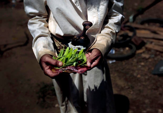 APTOPIX Yemen Displaced into Hunger Photo Essay