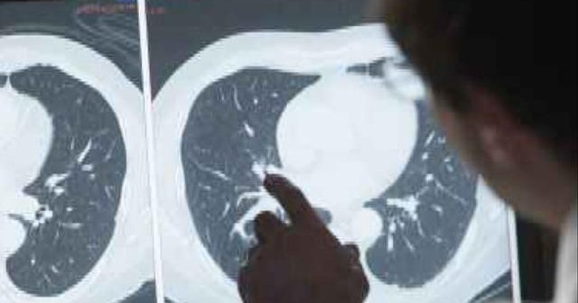 Researchers hope new vaccine could improve odds for pancreatic cancer