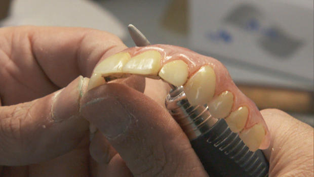 rami-malek-fake-teeth-by-chris-lyons-620.jpg 