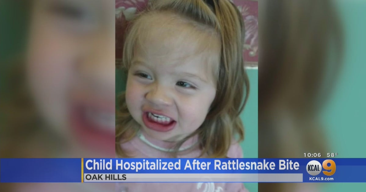 Little Girl Recovers In Hospital After Being Bitten By Rattlesnake