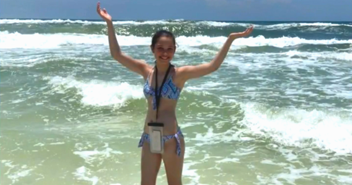 Flesh-eating disease: 12-year-old contracts flesh-eating bacteria during vacation in Destin, Florida - CBS News thumbnail