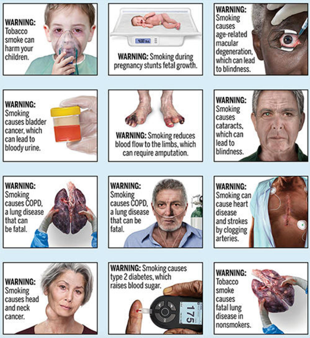 Cigarette warning labels: FDA wants to put graphic warnings on