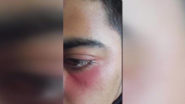 1017-newspath-syrianteenattacked-1954008-640x360.jpg