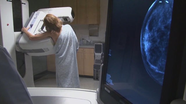 ctm-1031-mammograms.jpg 