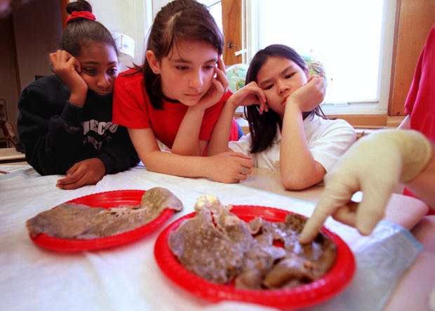 UM students showing 5th grade students at Homecroft School damaged human organs - St. Paul, Minnesota - March 24, 2000 -- St. Paul Homecroft Elementary school 5th grade students, left to right, Myeshia Ford, Laura Ene and Phuong Nguyen compare the visual 