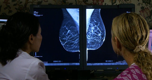 Morning Rounds: 3D mammograms enhance cancer screening