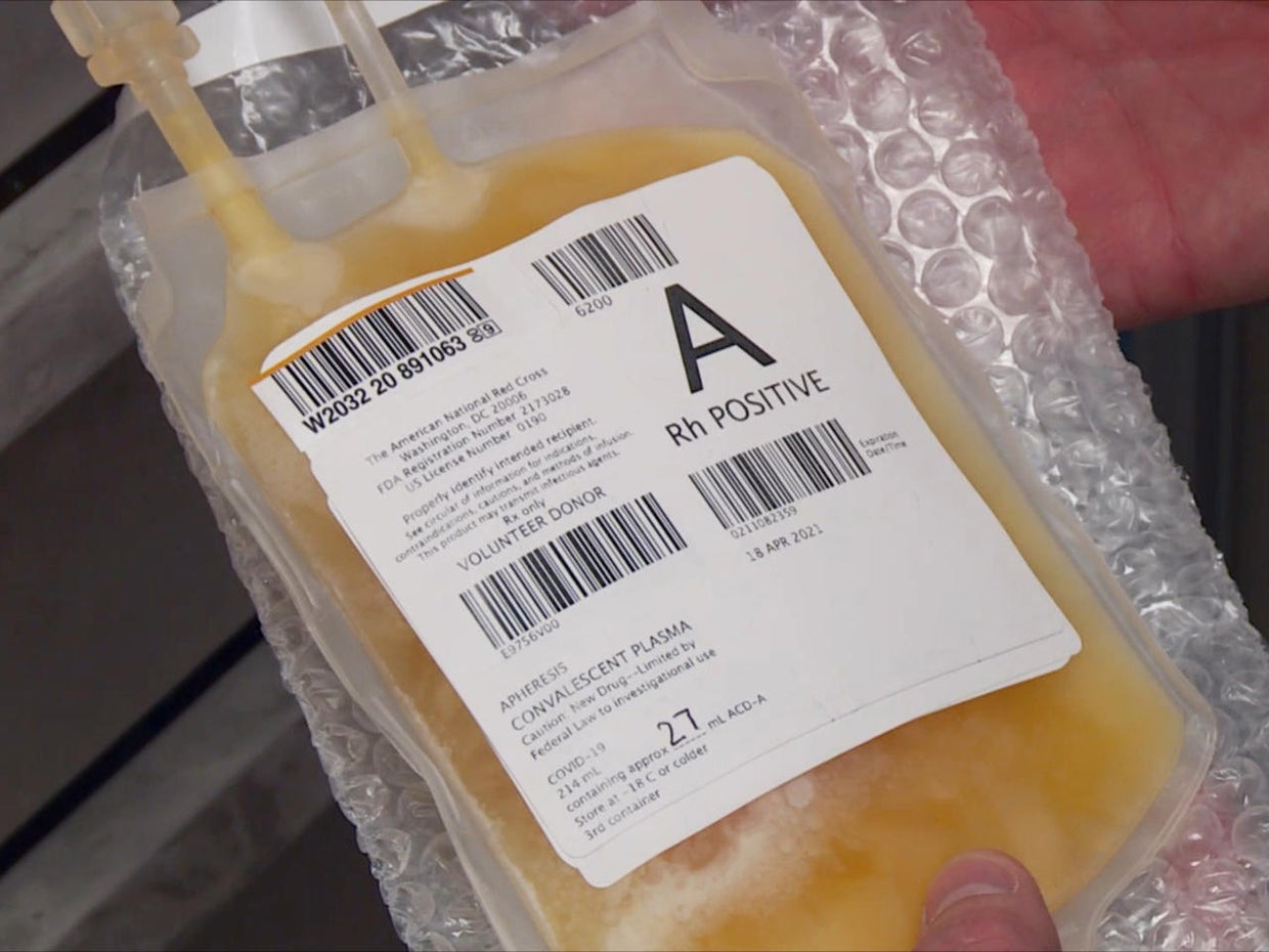 How plasma transfusions may heal COVID19 patients CBS News