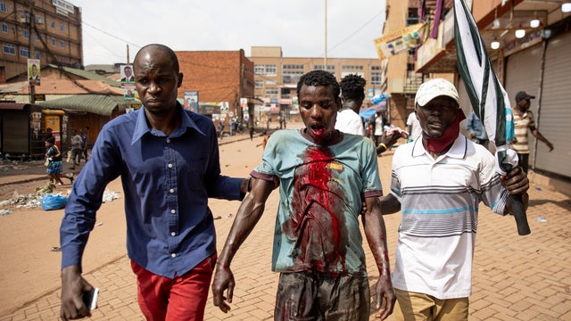 Rioting Continues In Kampala After Arrest Of Opposition Presidential Candidate 