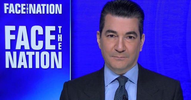 Gottlieb fairly confident that new Brazilian virus strain is already in the U.S