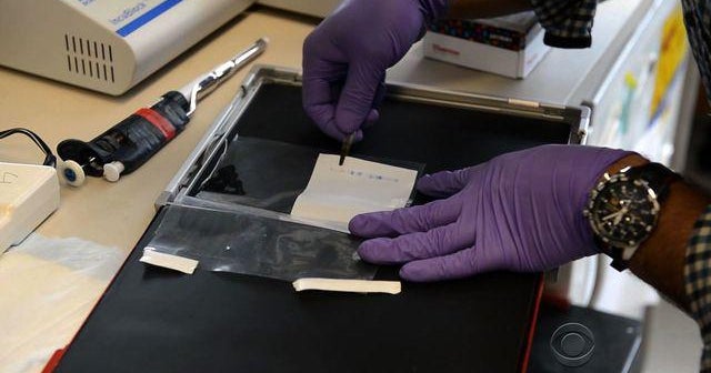 Could gene therapy hold key in AIDS fight?