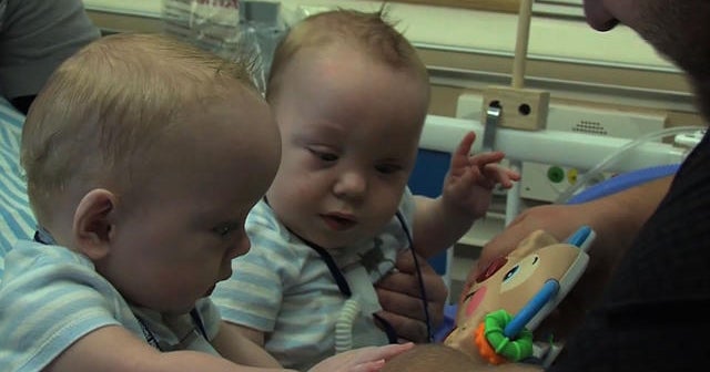 Once-conjoined twins head home from hospital