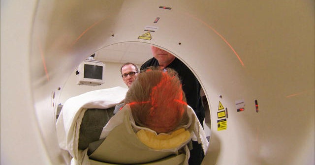 The search for a cure for Alzheimer&rsquo;s