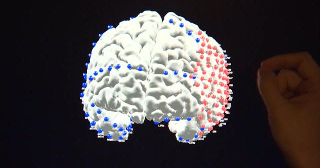 Research could help panic disorders, anxiety