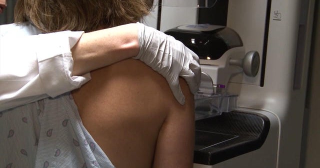Risk of false positives from mammograms