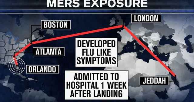 MERS virus threat: CDC racing to find those possibly exposed