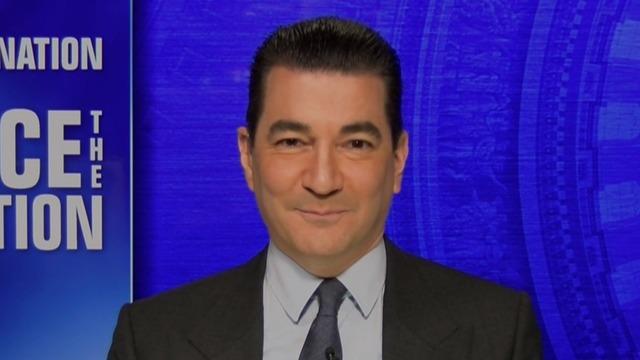 Gottlieb Warns Of Potential For New Outbreaks Fueled By New York Virus Variant Cbs News