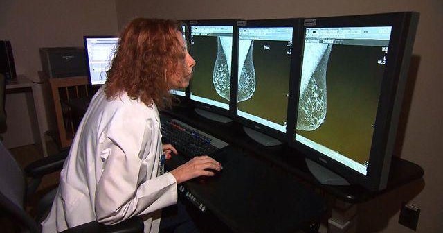 Cholesterol linked to breast cancer; Molecule tied to metabolic health