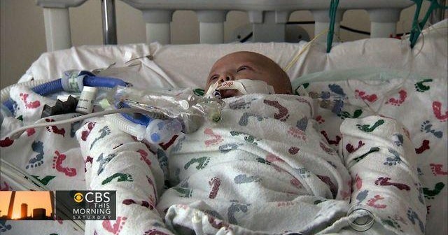 Whooping cough cases soar in California