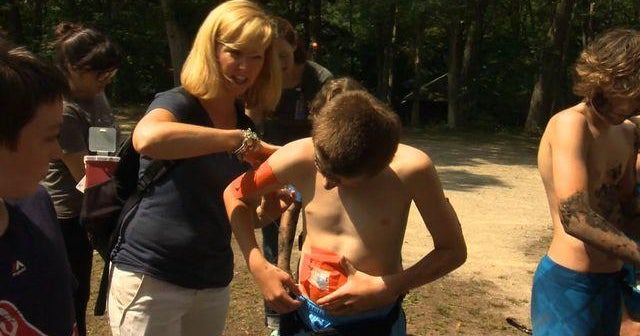 Researchers test bionic pancreas at camp for diabetic kids