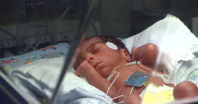 Texas woman gives birth to quadruplets