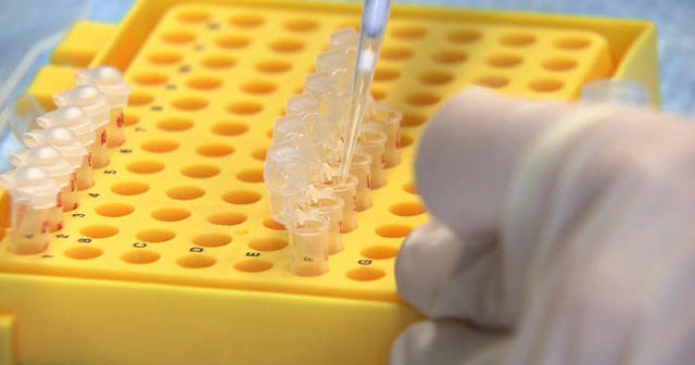 U.S. to begin testing experimental Ebola vaccine