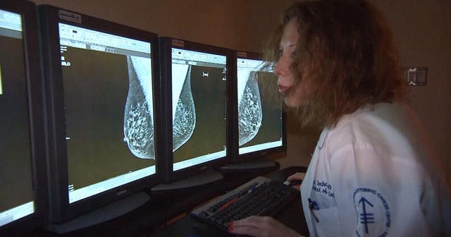 Experts plead for help treating advanced breast cancer