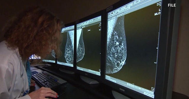 Promising new breast cancer vaccine